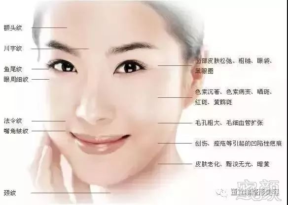 https://img.miyanlife.com/mnt/timg/181011/1255252639-4.jpg