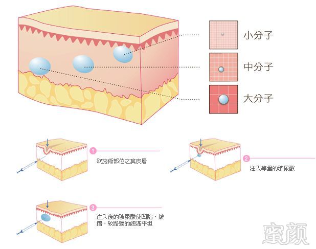 案例图片