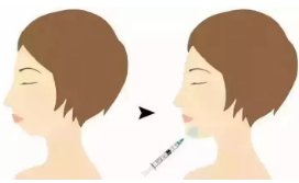 https://img.miyanlife.com/mnt/timg/181011/131K96430-5.jpg