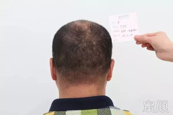 https://img.miyanlife.com/mnt/timg/181011/13212G912-3.jpg