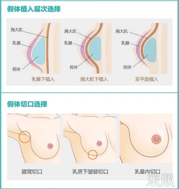 案例图片