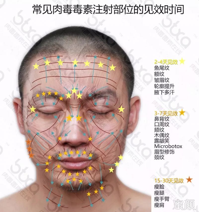 https://img.miyanlife.com/mnt/timg/181012/1055096441-0.jpg