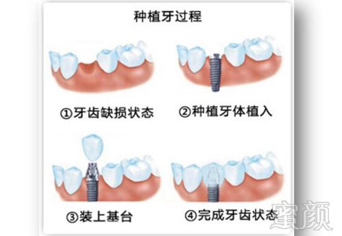 案例图片