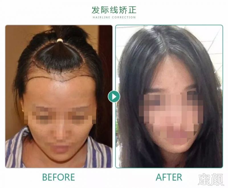 https://img.miyanlife.com/mnt/timg/181012/1256492961-6.jpg