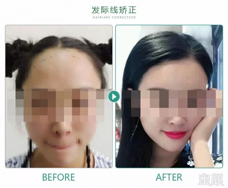 https://img.miyanlife.com/mnt/timg/181012/12564S523-5.jpg
