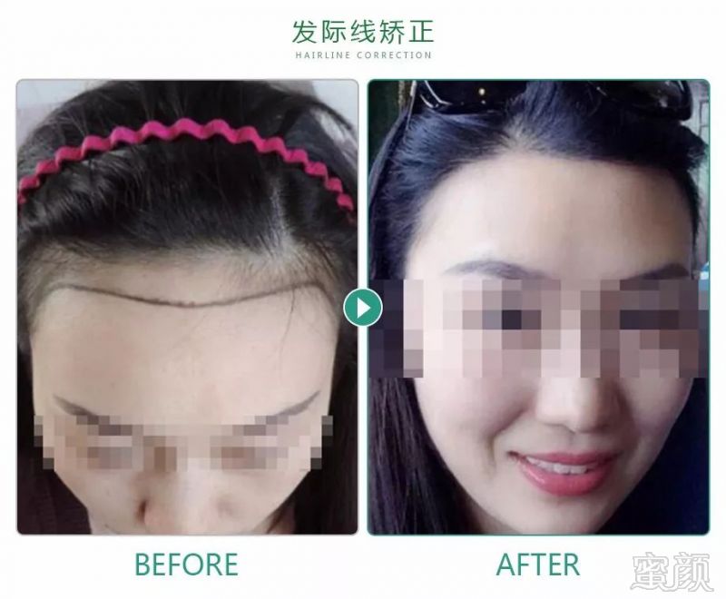 https://img.miyanlife.com/mnt/timg/181012/12564U610-1.jpg