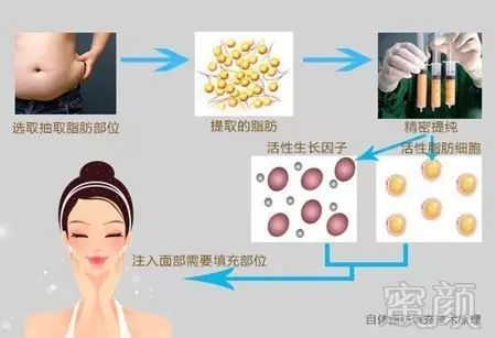 https://img.miyanlife.com/mnt/timg/181012/13020014O-8.jpg