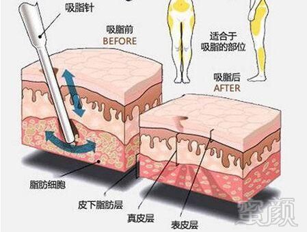 案例图片