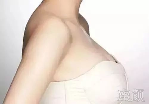 https://img.miyanlife.com/mnt/timg/181013/1049533063-5.jpg