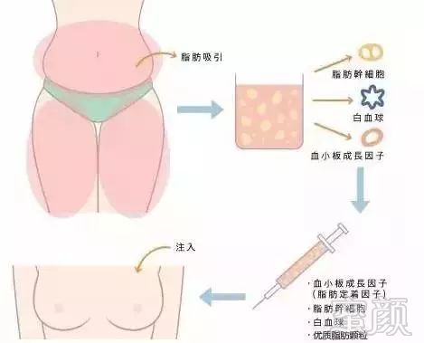 https://img.miyanlife.com/mnt/timg/181013/1049534L9-4.jpg