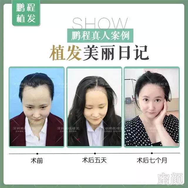 https://img.miyanlife.com/mnt/timg/181013/11055515R-5.jpg