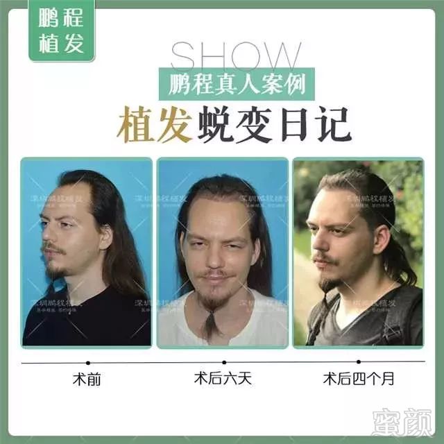 https://img.miyanlife.com/mnt/timg/181013/110555F00-4.jpg