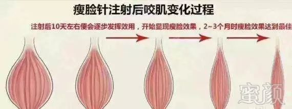 https://img.miyanlife.com/mnt/timg/181013/11093BW3-6.jpg