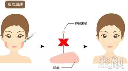 https://img.miyanlife.com/mnt/timg/181013/11093C110-2.jpg