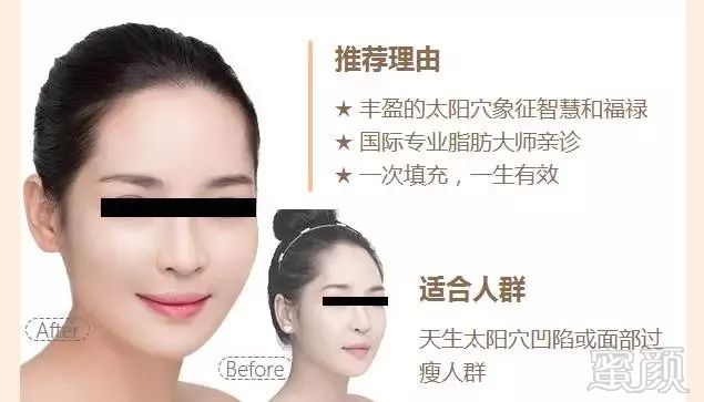 https://img.miyanlife.com/mnt/timg/181013/11164Q641-6.jpg