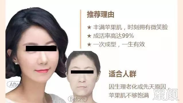 https://img.miyanlife.com/mnt/timg/181013/11164R3X-8.jpg
