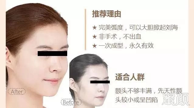 https://img.miyanlife.com/mnt/timg/181013/11164U5A-7.jpg