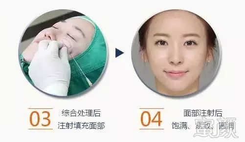 https://img.miyanlife.com/mnt/timg/181013/11164VE8-4.jpg