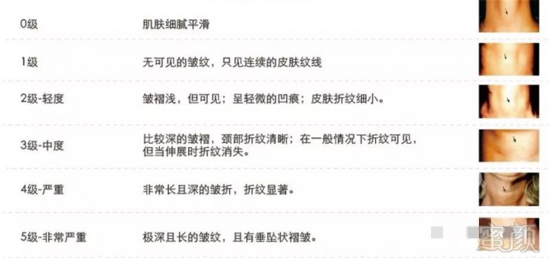 https://img.miyanlife.com/mnt/timg/181014/0925391H1-2.jpg