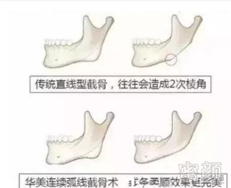 案例图片