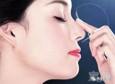 https://img.miyanlife.com/mnt/timg/181014/112F54Q3-1.jpg