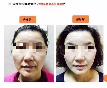 https://img.miyanlife.com/mnt/timg/181015/12091CN8-7.jpg