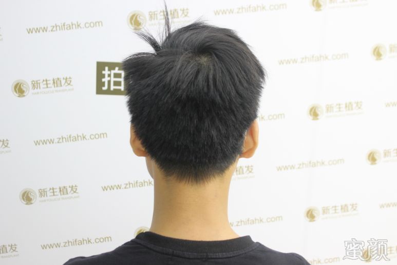 https://img.miyanlife.com/mnt/timg/181015/1236235T0-1.jpg