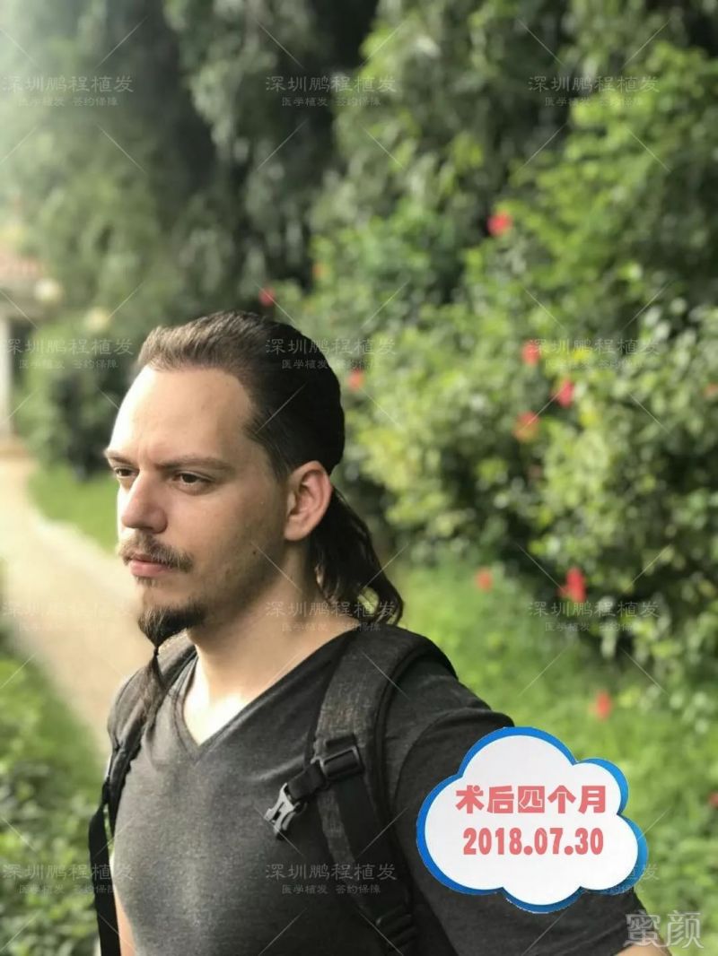 https://img.miyanlife.com/mnt/timg/181016/10201114B-4.jpg