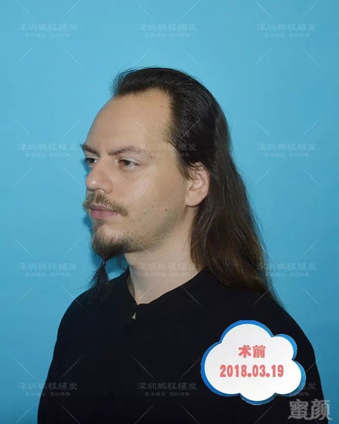 https://img.miyanlife.com/mnt/timg/181016/1020113R7-0.jpg