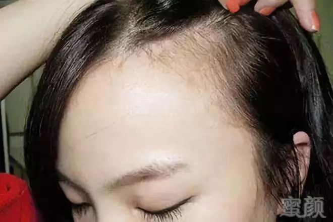 https://img.miyanlife.com/mnt/timg/181016/1020332321-0.jpg