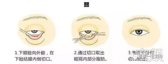 https://img.miyanlife.com/mnt/timg/181016/131Z46352-2.jpg