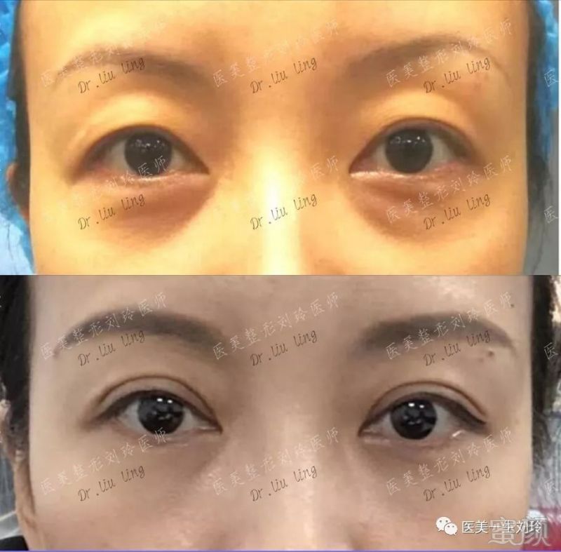 https://img.miyanlife.com/mnt/timg/181016/131Z64309-10.jpg