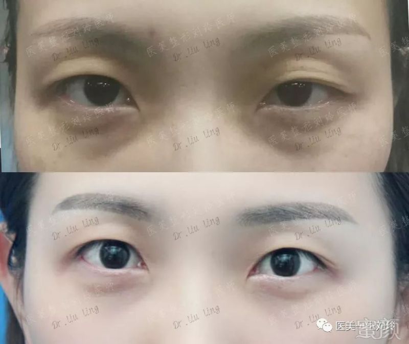 https://img.miyanlife.com/mnt/timg/181016/131ZB620-11.jpg