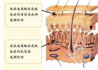 案例图片