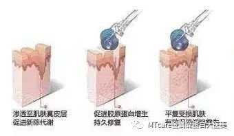 https://img.miyanlife.com/mnt/timg/181017/114U340T-3.jpg
