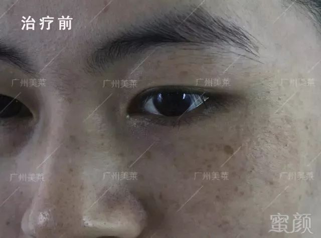 https://img.miyanlife.com/mnt/timg/181017/1251234A8-3.jpg
