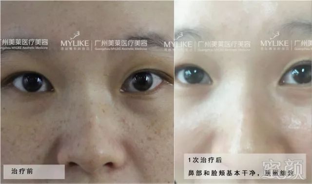 https://img.miyanlife.com/mnt/timg/181017/12512352T-1.jpg