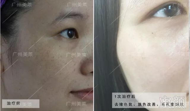 https://img.miyanlife.com/mnt/timg/181017/1251235564-2.jpg