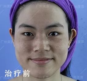 https://img.miyanlife.com/mnt/timg/181017/1251235T2-4.jpg