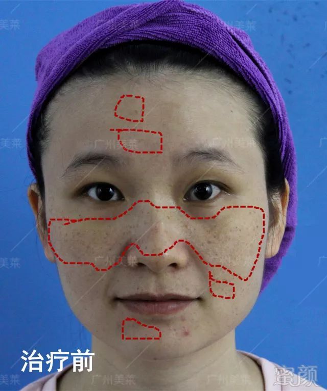 https://img.miyanlife.com/mnt/timg/181017/1251236092-0.jpg