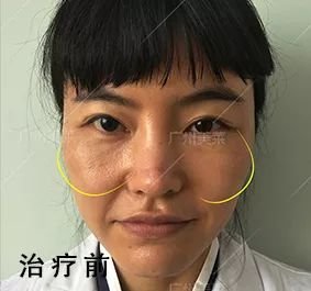 https://img.miyanlife.com/mnt/timg/181017/12512411I-7.jpg