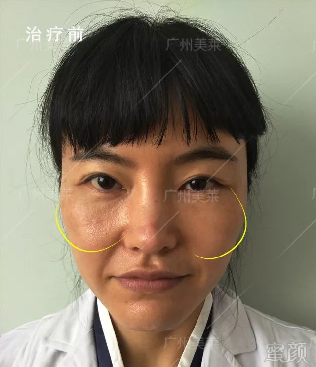 https://img.miyanlife.com/mnt/timg/181017/1251241L0-6.jpg
