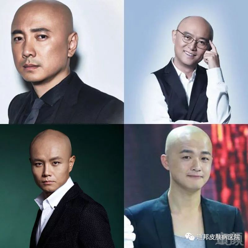 https://img.miyanlife.com/mnt/timg/181018/121A16118-0.jpg