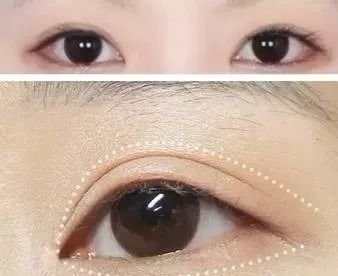 https://img.miyanlife.com/mnt/timg/181018/12505G512-0.jpg