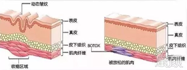 案例图片