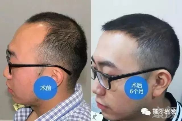 https://img.miyanlife.com/mnt/timg/181019/132040I38-9.jpg