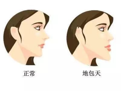 https://img.miyanlife.com/mnt/timg/181020/152014F37-3.jpg