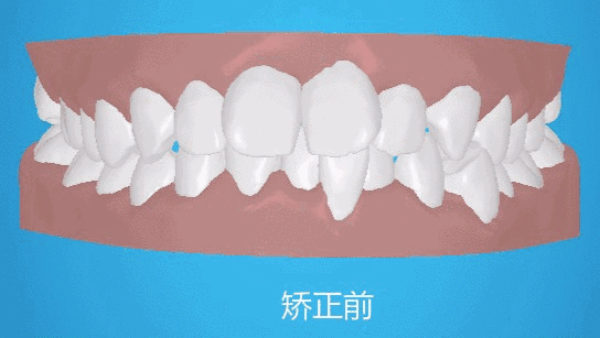 https://img.miyanlife.com/mnt/timg/181020/15202910X-12.jpg
