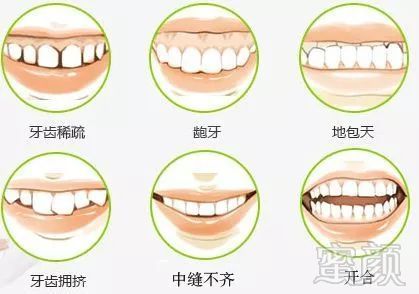 https://img.miyanlife.com/mnt/timg/181020/1520295B9-9.jpg