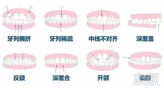 https://img.miyanlife.com/mnt/timg/181020/15203415H-15.jpg